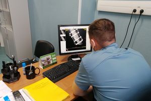 Травматологи Сургута спасают от тяжелой инвалидности 20-летнего югорчанина с переломами обеих ног