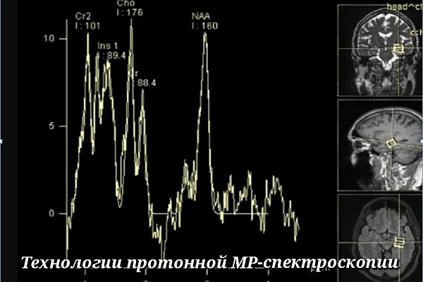 В международный День рентгенолога достижения диагностической службы травмбольницы будут представлены на всероссийском профессиональном конгрессе