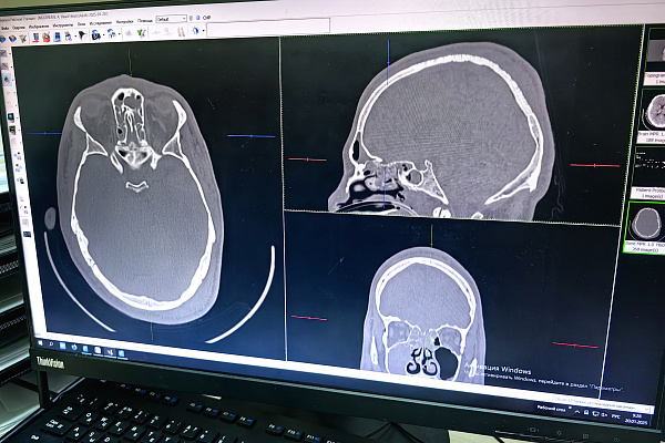 Рентгенологи Сургутской травмбольницы дистанционно обрабатывают КТ-снимки пациентов макеевской клиники