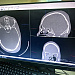 Рентгенологи Сургутской травмбольницы дистанционно обрабатывают КТ-снимки пациентов макеевской клиники