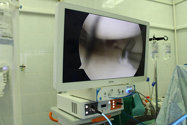 Для высокотехнологичных и высокоточных операций. Сургутская травмбольница получила новое артроскопическое оборудование