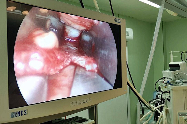 В Сургутской травмбольнице  начали выполнять уникальные для Югры малоинвазивные вмешательства при карпальном туннельном синдроме 