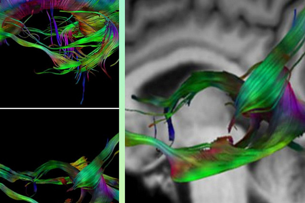 В международный День рентгенолога достижения диагностической службы травмбольницы будут представлены на всероссийском профессиональном конгрессе