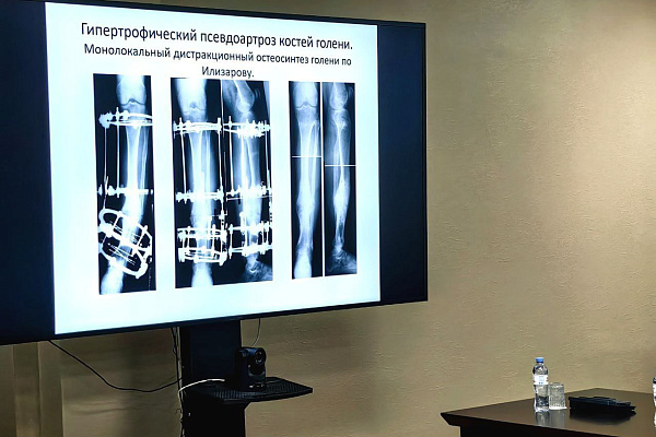 Центральным событием юбилейного для Сургутской травмбольницы года стала большая мультидисциплинарная конференция 