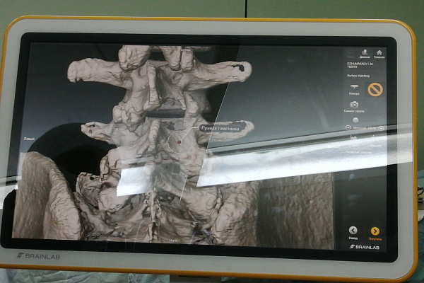 Точность и безопасность при сложнейших операциях на спинном и головном мозге. В Сургутскую травмбольницу поступило современное нейронавигационное оборудование