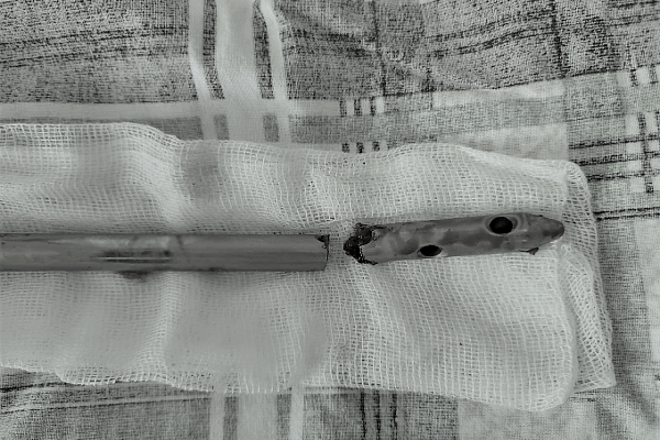 Уже не дети, но ещё не взрослые. Об особенностях лечения травм в подростковом возрасте