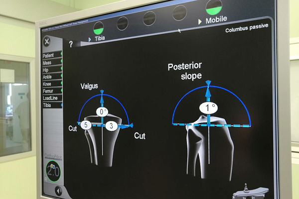 С точностью до миллиметра. Травматологи-ортопеды осваивают новую навигационную программу для эндопротезирования суставов