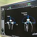 С точностью до миллиметра. Травматологи-ортопеды осваивают новую навигационную программу для эндопротезирования суставов