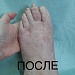Микрохирурги Травматологической больницы Сургута выполняют более 150 операций при деформации переднего, среднего и заднего отделов стопы