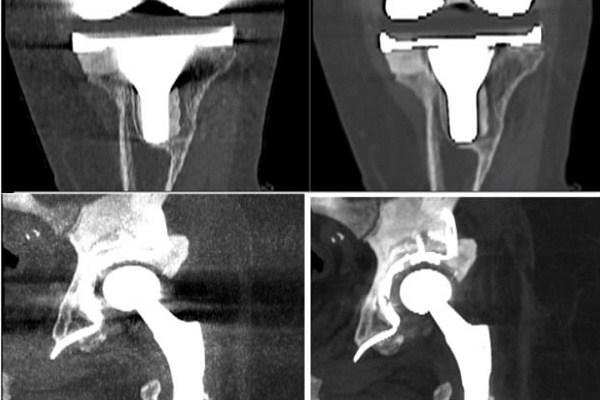 В международный День рентгенолога достижения диагностической службы травмбольницы будут представлены на всероссийском профессиональном конгрессе