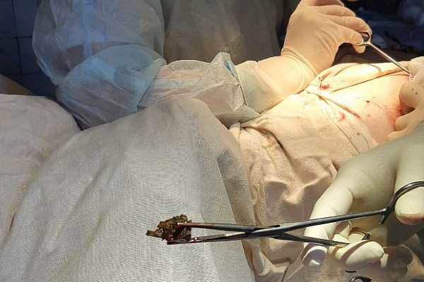 Три врача Сургутской травмбольницы побывали с начала года в Макеевке. На днях оттуда вернулся травматолог-ортопед Вячеслав Липатников.