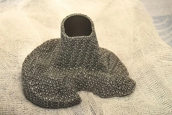 В Сургутской травмбольнице впервые выполнили эндопротезирование коленного сустава с установкой 3D-импланта