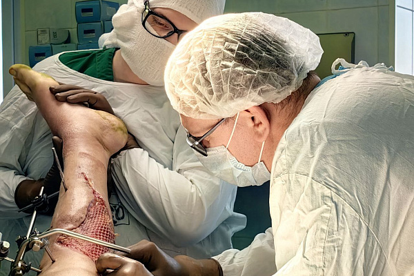 В Сургутской травмбольнице пациенту успешно провели этапное лечение тяжелой травмы нижней конечности после падения полуторатонной конструкции 