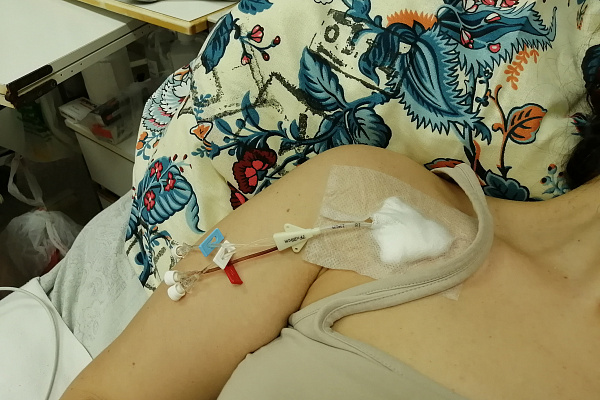 Печальные последствия невнимательности и самоуверенности: в Сургутской травмбольнице борются за жизнь пострадавших в череде ДТП